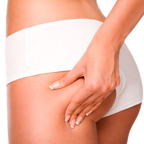 Celulitis Celulitis